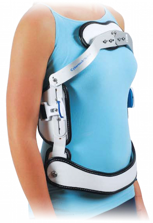 Spinal Orthoses